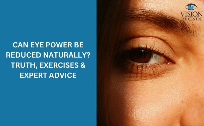 Eye Power Reduction: Natural Ways to Reduce Myopia with Exercises