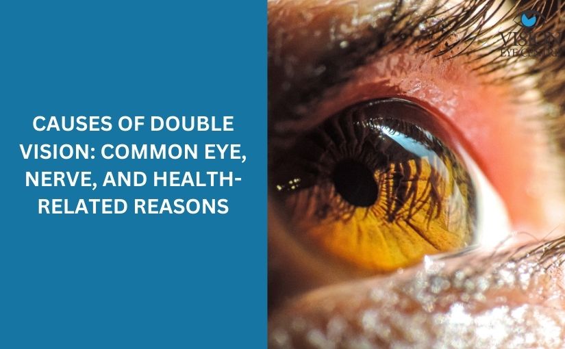 Causes of Double Vision: Common Eye, Nerve, and Health-Related Reasons