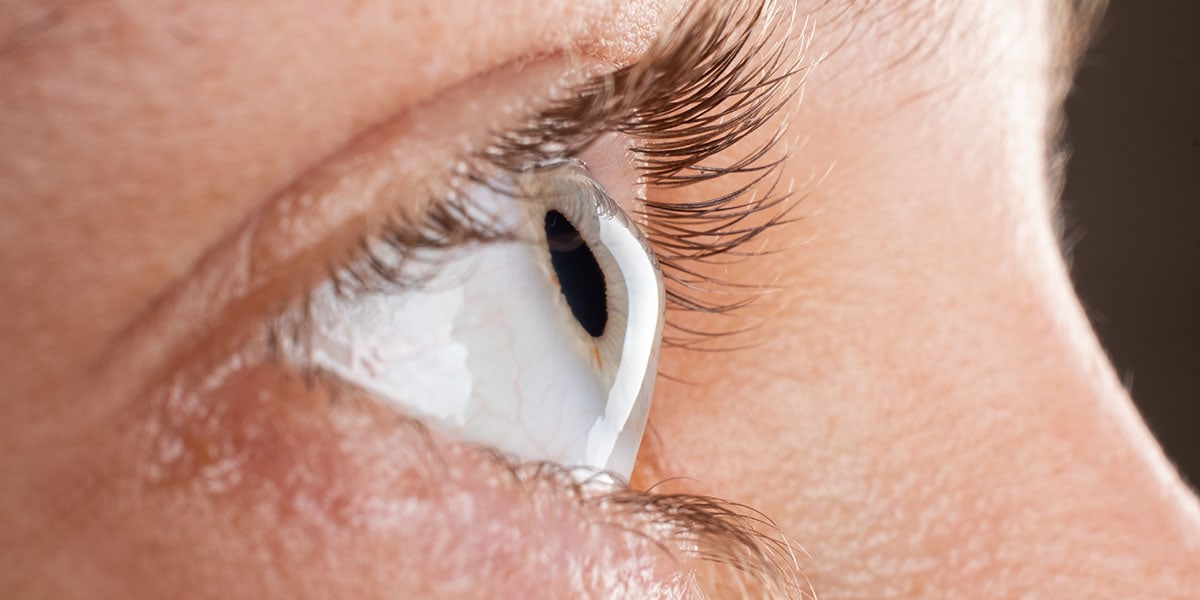 Clear Vision Ahead: Navigating Keratoconus and Your Treatment Options