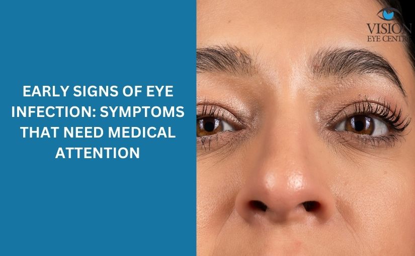 Early Signs of Eye Infection: Symptoms That Need Medical Attention