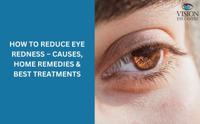 how to reduce eye redness – Causes, Home Remedies & Best Treatments