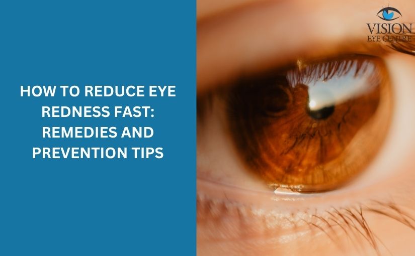Fast Eye Redness Relief: Home Remedies & Medical Treatments