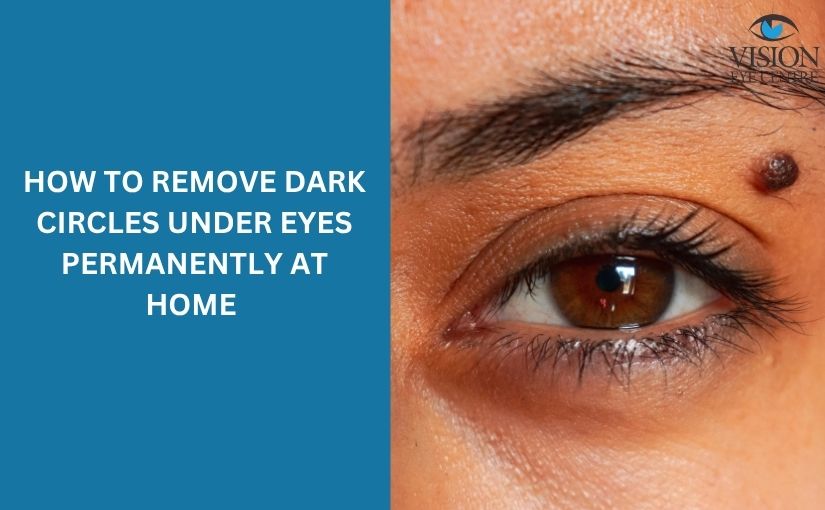 Remove Dark Circles Under Eyes: Natural Home Remedies & Treatments