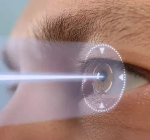 Does LASIK Eye Surgery Hurt?