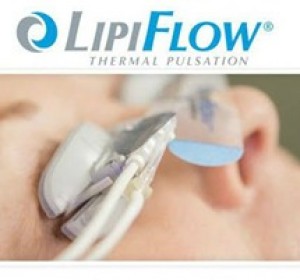 Is Dry Eye a Vitamin Deficiency? How Effective is LipiFlow Treatment?