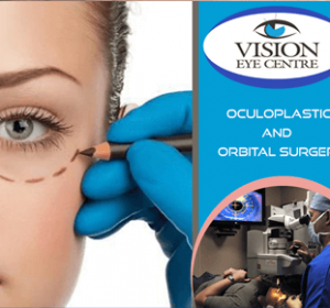 Oculoplastic and Orbital Surgery in Delhi | Vision Eye Centre