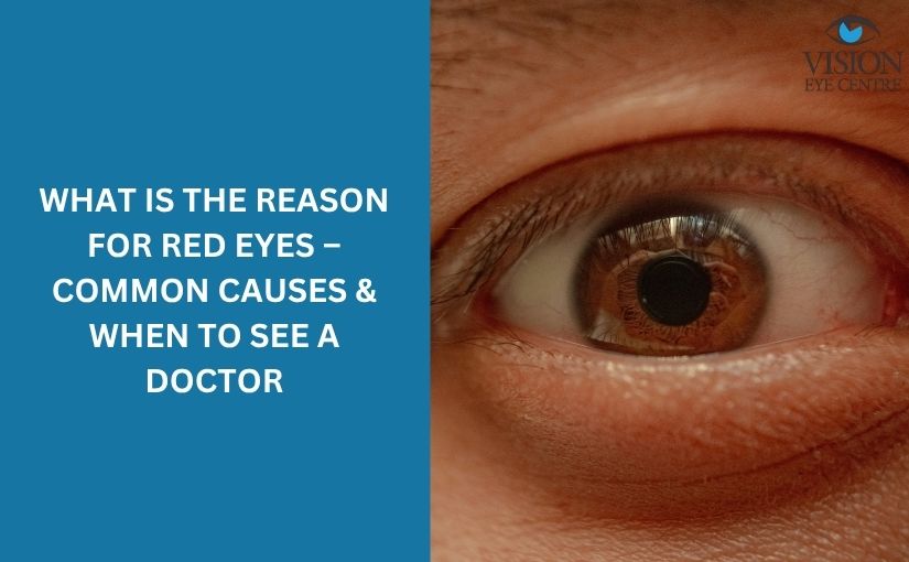 what is the reason for red eyes – Common Causes & When to See a Doctor