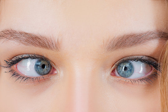 What is the Treatment for Squint Eye? {Detailed Guide}