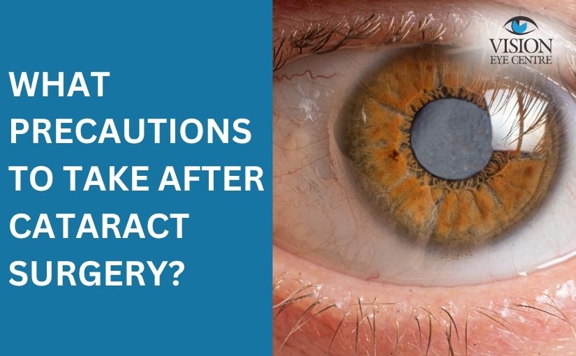 What Precautions to Take After Cataract Surgery?