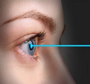 Femtosecond Laser Bladeless Cataract surgery