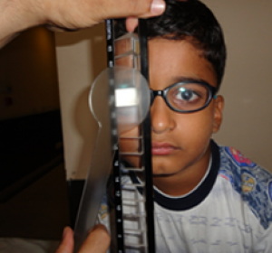 Squint Eye Surgery in Delhi: Vision Eye Centre